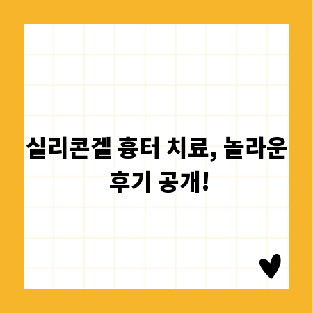실리콘겔 흉터 치료, 놀라운 후기 공개!